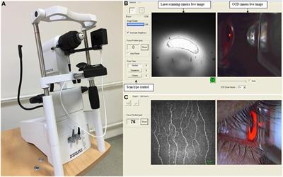 In Vivo Confocal Microscopic Evaluation of Corneal Nerve Fibers and Dendritic Cells in Patients With Behçet’s Disease